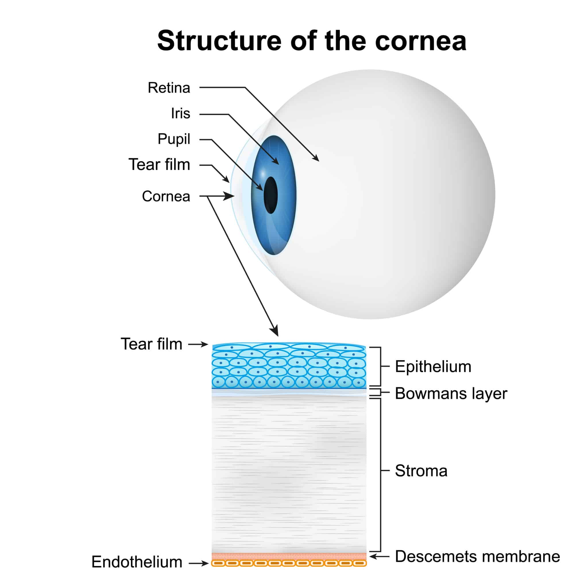 Why Corneal Thickness is Important in Laser Vision Correction